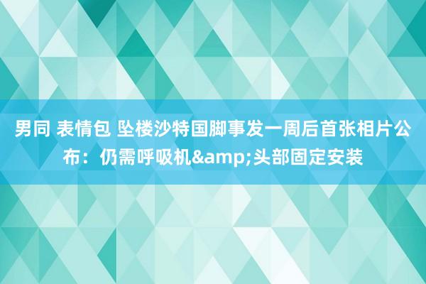 男同 表情包 坠楼沙特国脚事发一周后首张相片公布：仍需呼吸机&头部固定安装